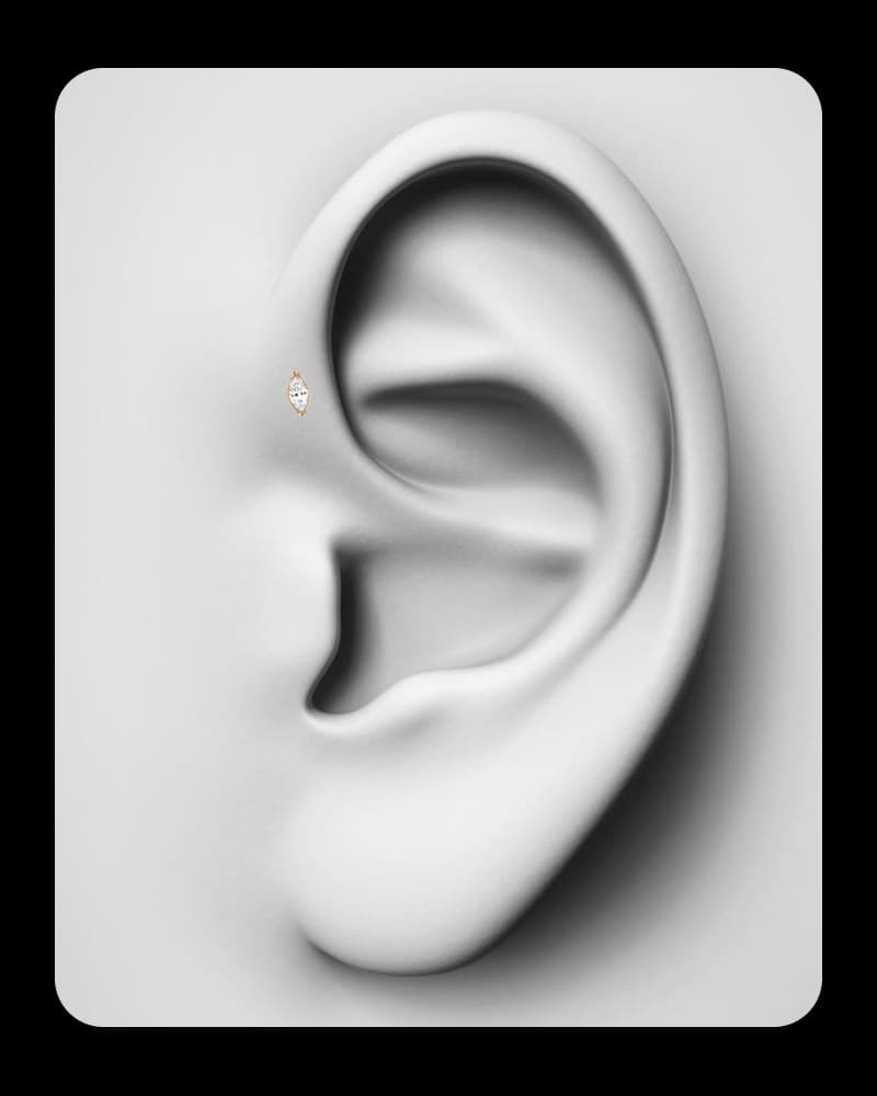 Helix frontal